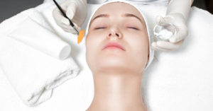 chemical peels melbourne