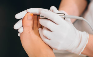 Lasers treatments for toenail fungus