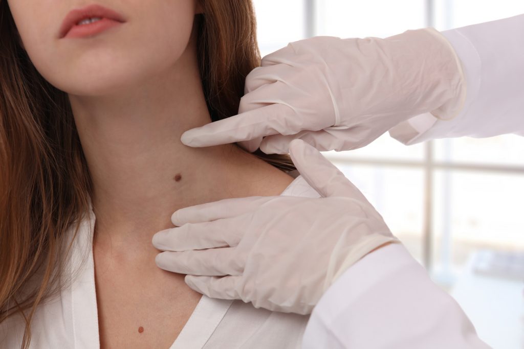 dermatologists treatment
