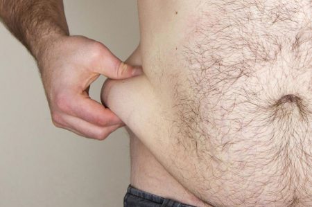 men's liposuction treatments