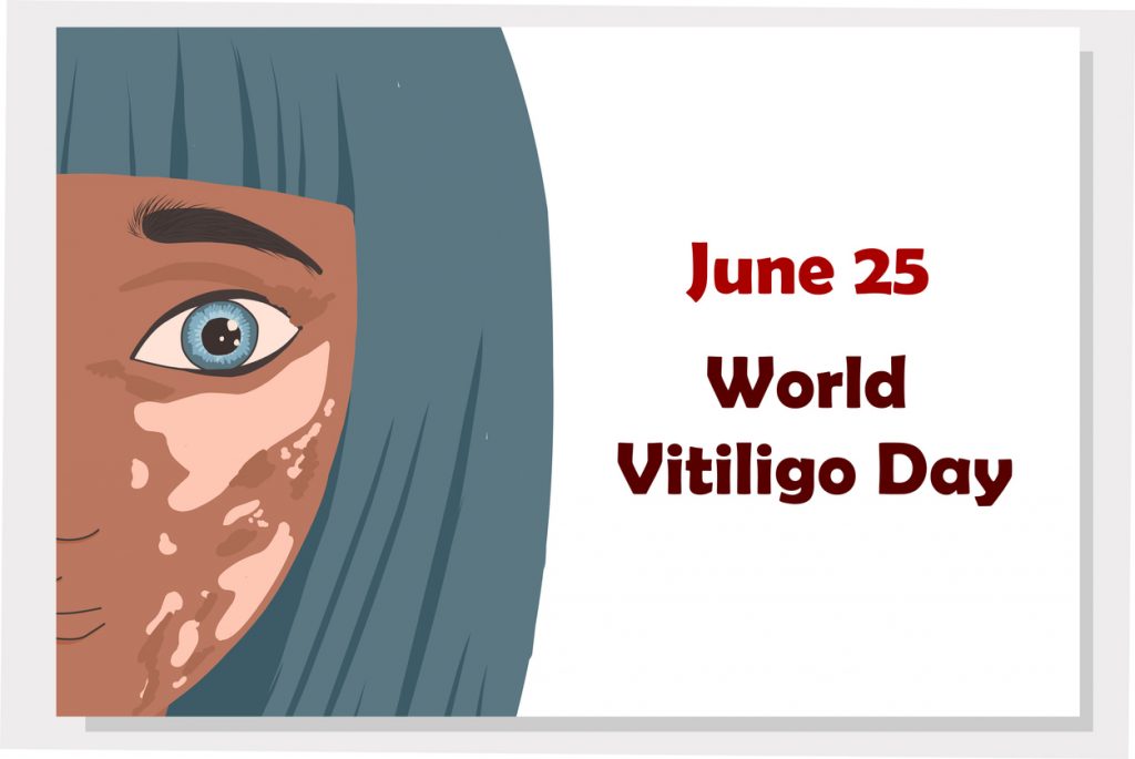 world vitiligo day 