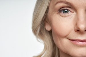 eye wrinkle treatments