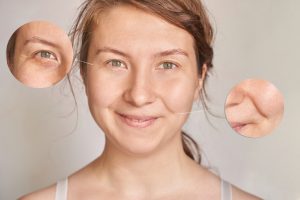 woman and close ups of her eye and smile lines