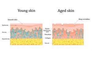 layers of skin infographic - young skin vs old skin