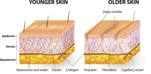 younger skin vs older skin infographic - skin layers