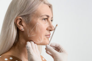 Marking the face with a white pencil for surgical intervention close-up