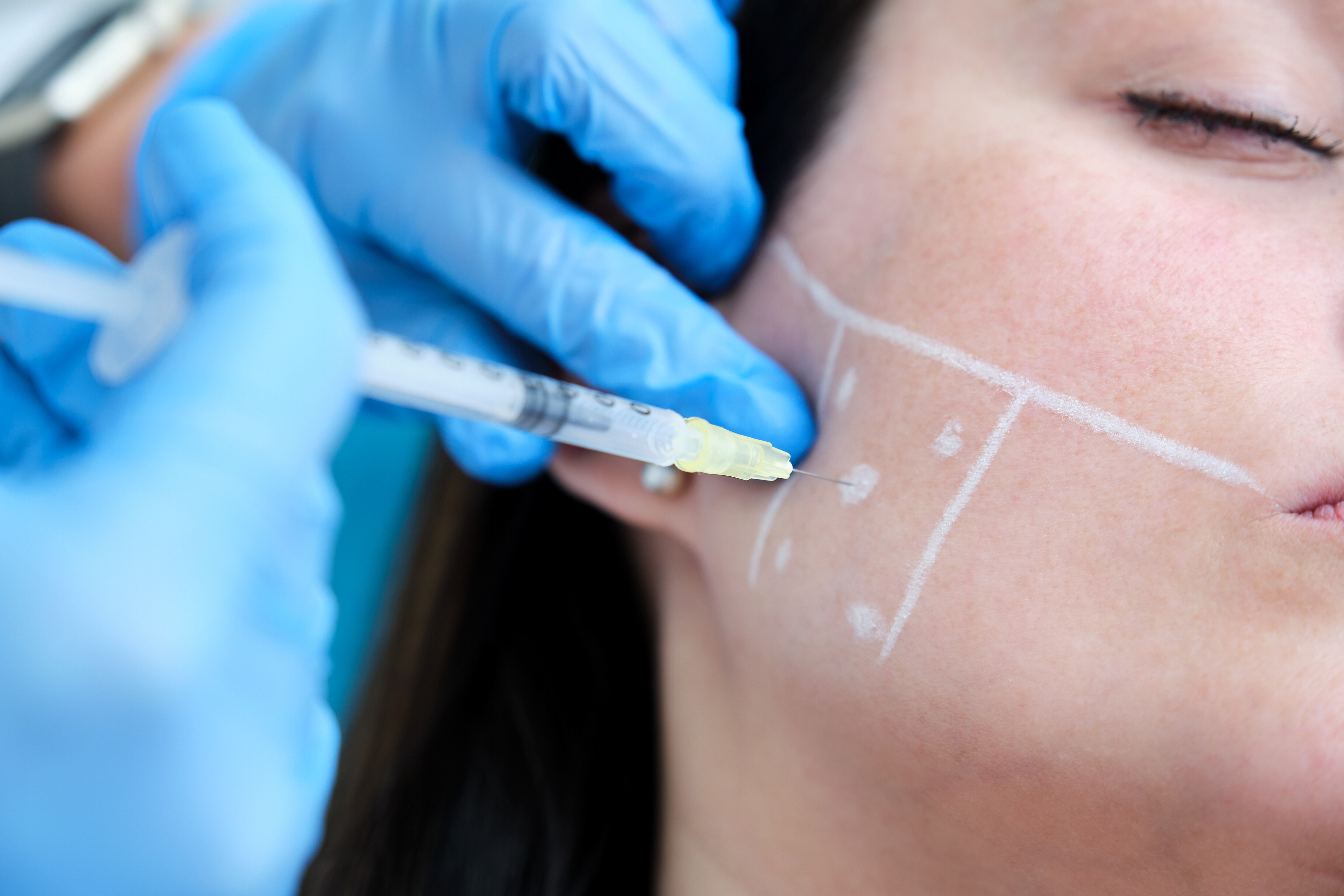injections into cheek for teeth grinding