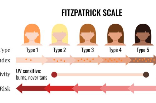 Fitzpatrick skin tone scale phototype melanin index with female avatar. Chart element with type I II III IV V IV human skin hair color melanin content in the cell cancer risk flat vector illustration