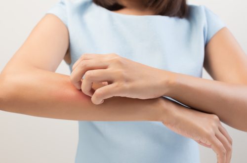 Itching why is my skin itchy